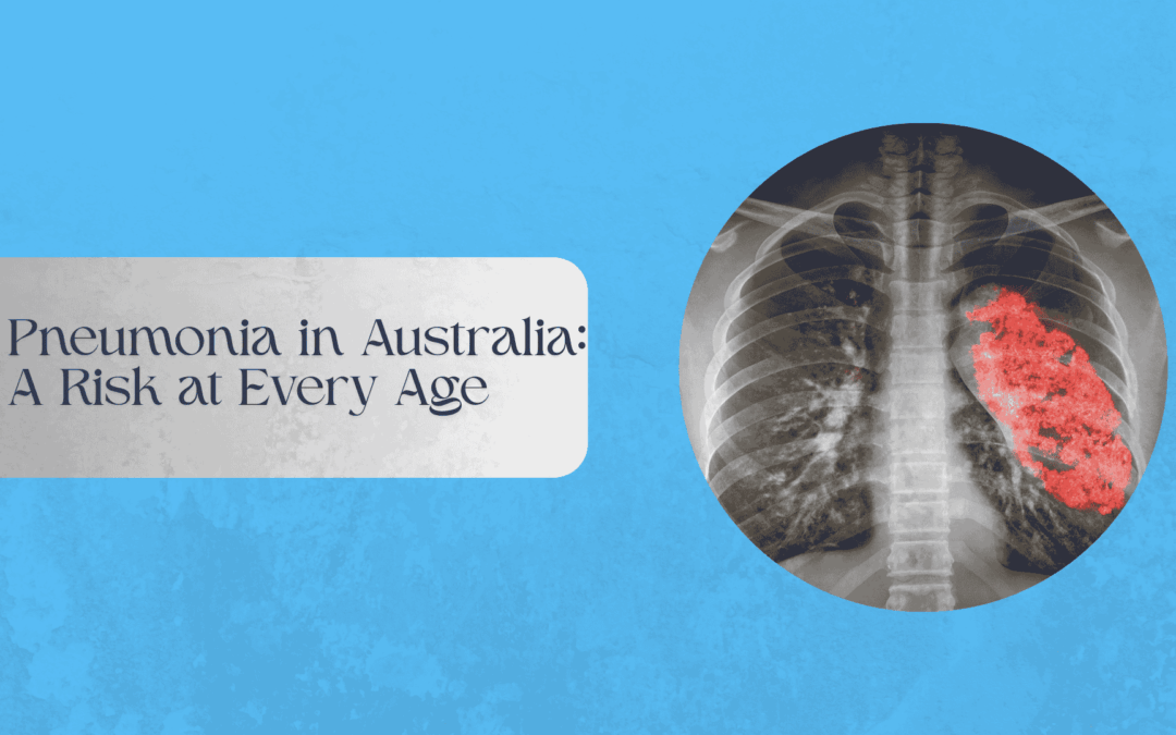 Pneumonia in Australia: A Risk at Every Age